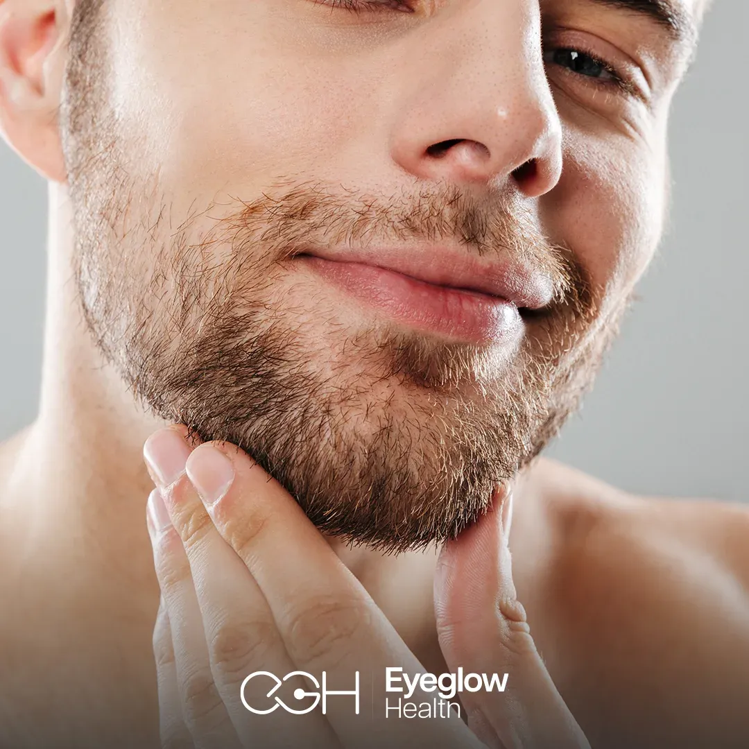 Beard and mustache transplant at Eyeglow, Istanbul