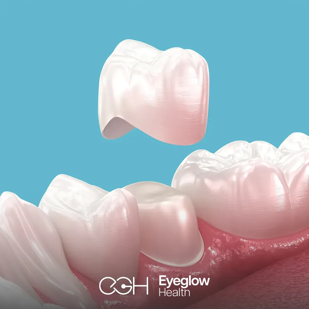 Zirconia crowns at Eyeglow, Istanbul